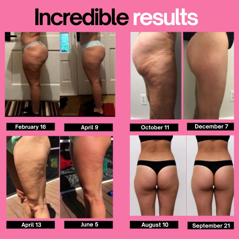 VELORA™ | Anti Cellulite Legging