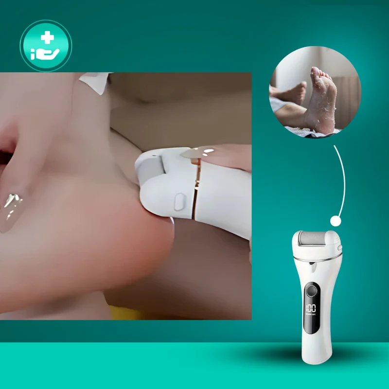 Dermasoft™ Hornhautentferner