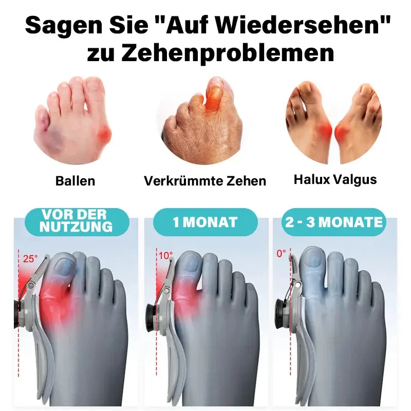 BunionRelief™ Ballenzeh-Korrektur