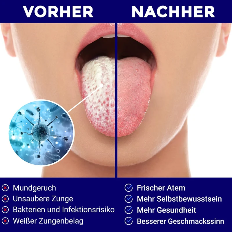 Zungenschaber Edelstahl | Dreier-Pack | Zungenreiniger | Für einen frischen Atem und eine bessere Mundgesundheit | Zungenreiniger Edelstahl | Zungenreiniger für Kinder und Erwachsene | ORAVIX