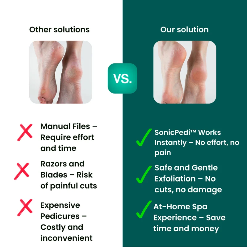SonicPedi™ Hornhautentferner