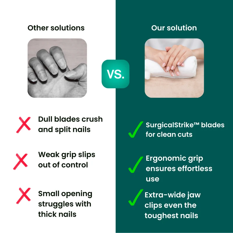 QuickTrim™ Nagelknipser