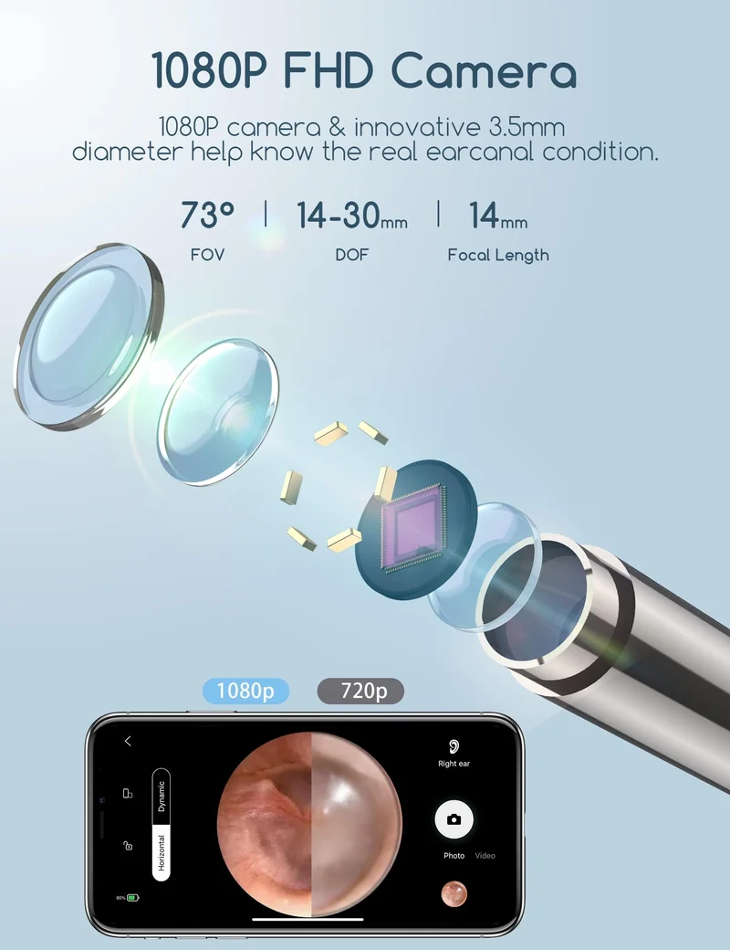 Ohrenschmalz-Entfernungs-Otoskop, WiFi Ohrreiniger, 1080P Ultra Thin HD Wireless wasserdichter Ohrspiegel mit 3,5 mm Objektiv und 6 LEDs für iPhone, iPad und Android Smartphones