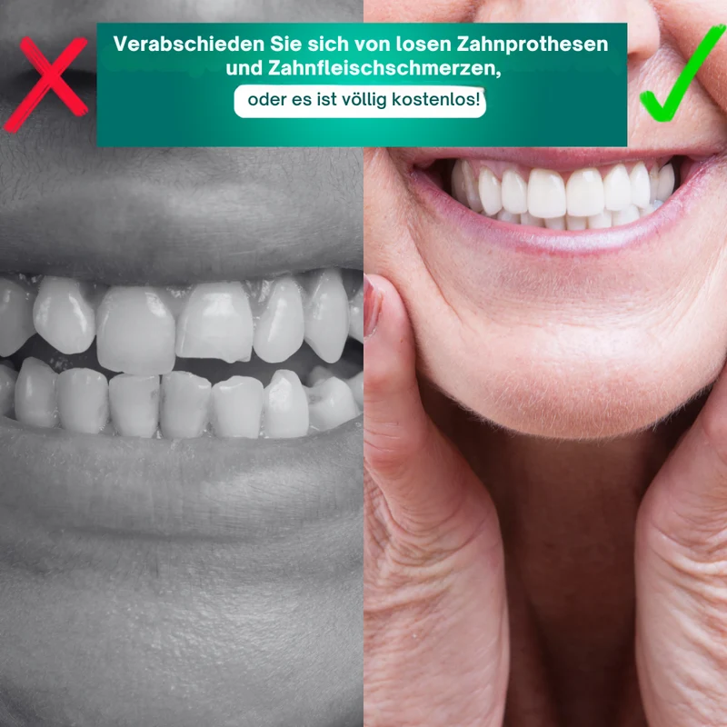 SmileSecure™ Zahnersatz