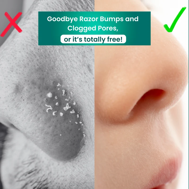 PorePrime™ Peeling-Bürste