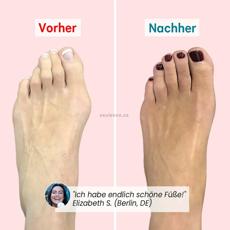 PerfectToes - Natürlicher Zehenkorrektor