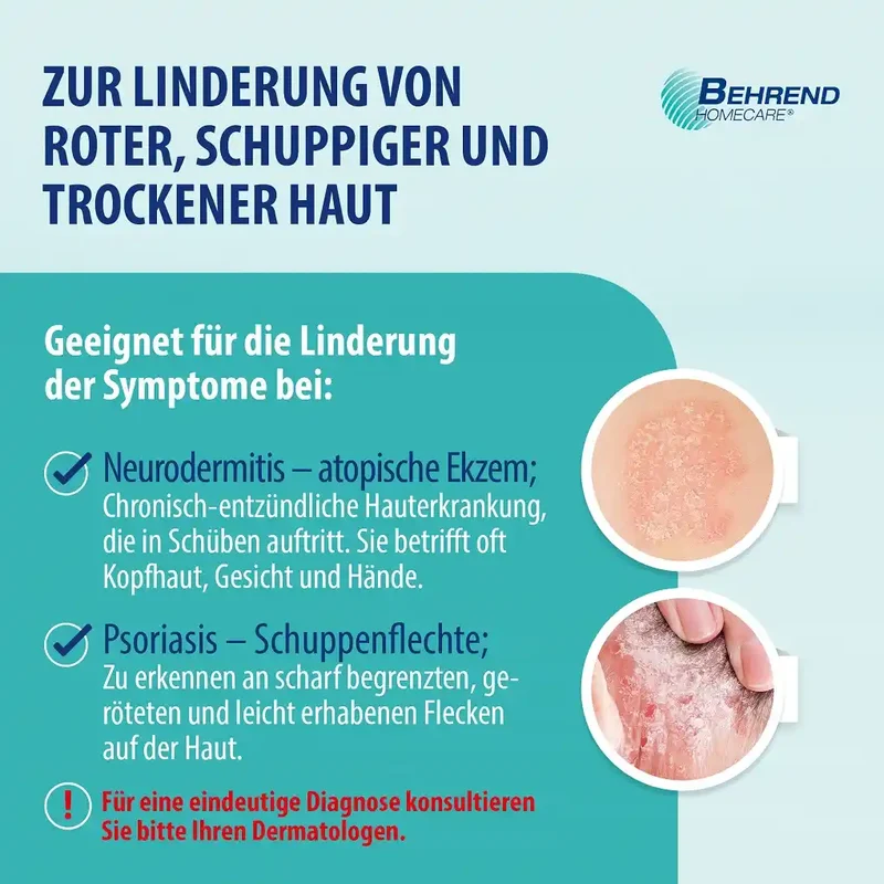Schuppenflechte & Neurodermitis Creme intensiv, 50ml
