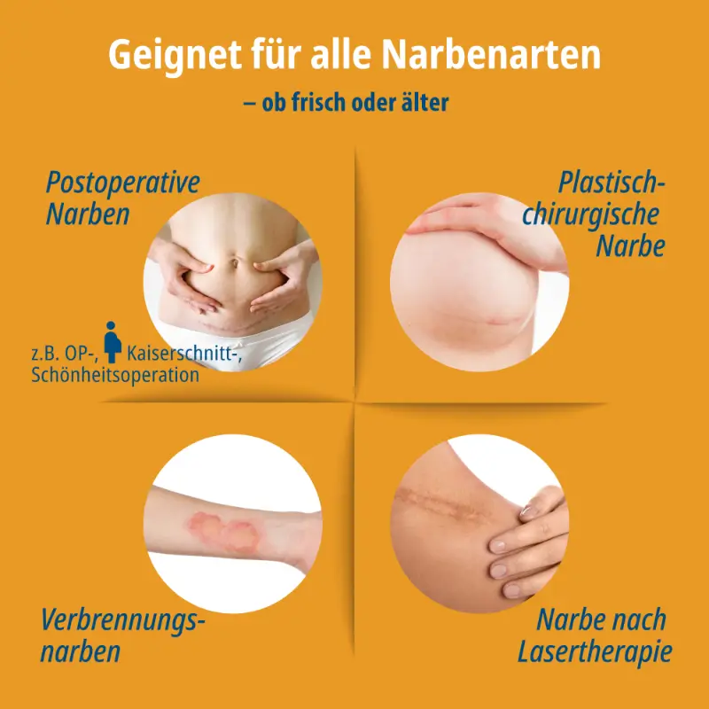 Narbenpflaster